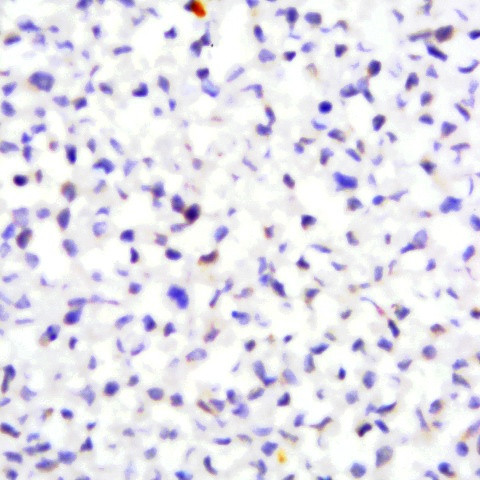 MMP-16/MT3-MMP Antibody in Immunocytochemistry (ICC/IF)