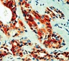 Vacular Endothelial Growth Factor (VEGF) Antibody in Immunohistochemistry (Paraffin) (IHC (P))