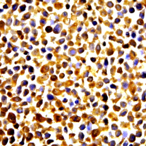 HSP84 Antibody in Immunocytochemistry (ICC/IF)