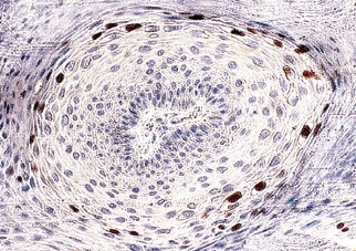 HPV 16 Antibody in Immunohistochemistry (PFA fixed) (IHC (PFA))