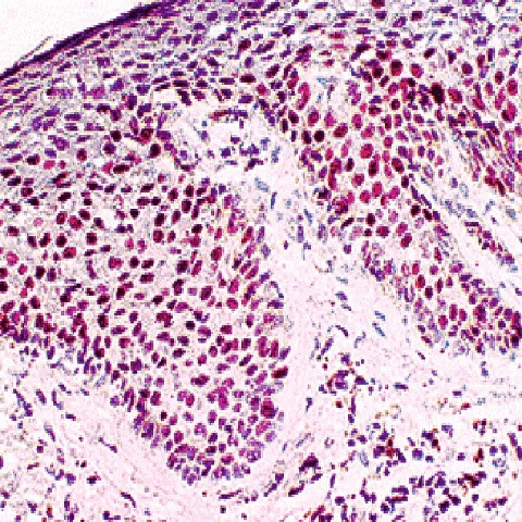 p21/WAF1 Antibody in Immunohistochemistry (Paraffin) (IHC (P))