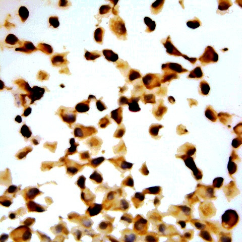 p57 /Kip2 Antibody in Immunocytochemistry (ICC/IF)