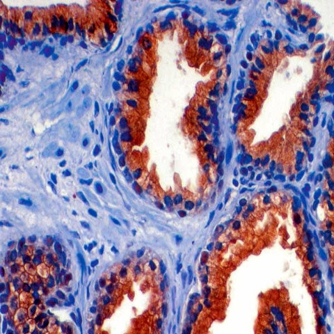 Prostate Specific Acid Phosphatase (PSAP) Antibody in Immunohistochemistry (Paraffin) (IHC (P))