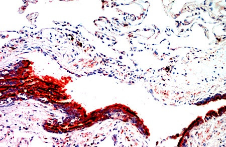 Tubulin-b Antibody in Immunohistochemistry (Paraffin) (IHC (P))