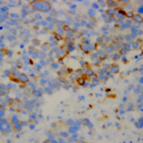 Chromogranin A Antibody in Immunohistochemistry (Paraffin) (IHC (P))