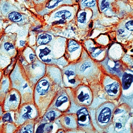 EGFR 1 Antibody in Immunohistochemistry (Paraffin) (IHC (P))