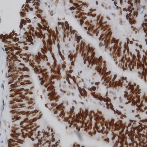 p53 Antibody in Immunohistochemistry (Paraffin) (IHC (P))