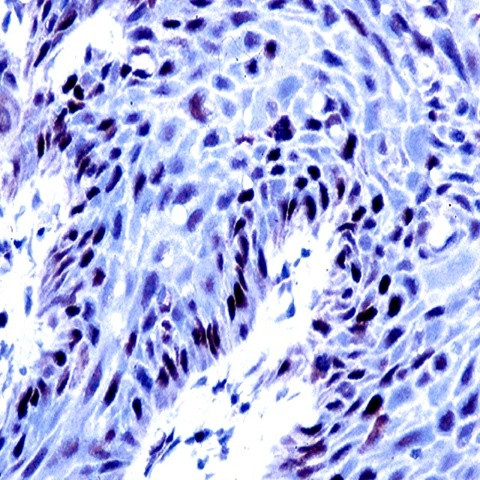 Retinoblastoma (RB) Antibody in Immunohistochemistry (Paraffin) (IHC (P))
