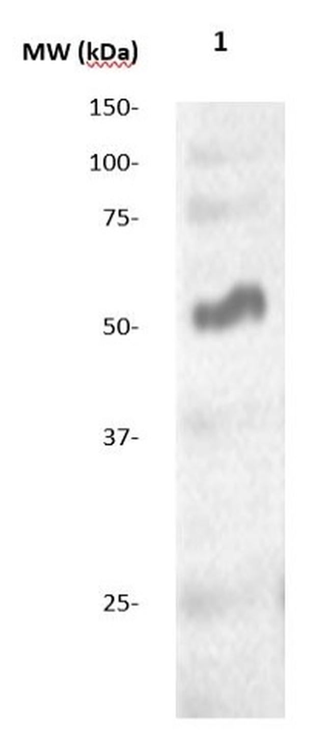 Alkaline Phosphatase (AP) Antibody in Western Blot (WB)