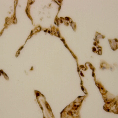 BCL-10 Antibody in Immunohistochemistry (Paraffin) (IHC (P))