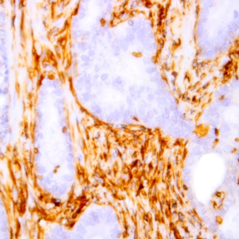 CDC37 Antibody in Immunohistochemistry (Paraffin) (IHC (P))