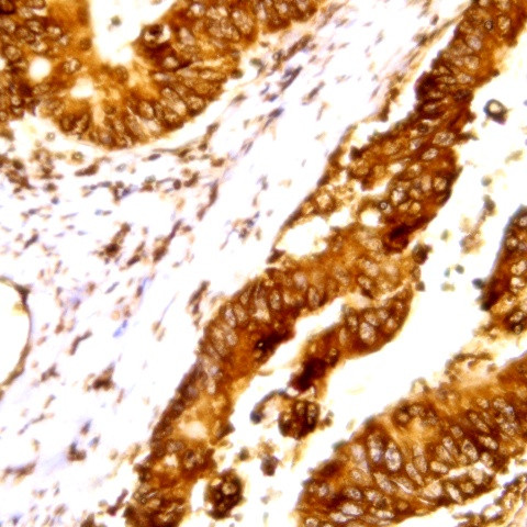 Cdk3 Antibody in Immunohistochemistry (Paraffin) (IHC (P))
