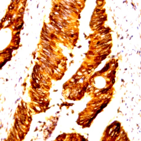 Cdk8 Antibody in Immunohistochemistry (Paraffin) (IHC (P))