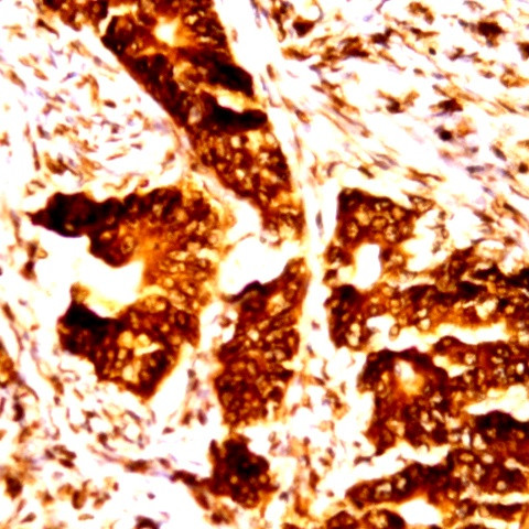 c-erbB-3/HER-3 Antibody in Immunohistochemistry (Paraffin) (IHC (P))