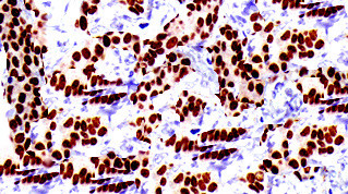Cyclin C Antibody in Immunohistochemistry (Paraffin) (IHC (P))