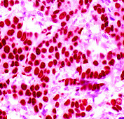 Heat Shock Factor 1 Antibody in Immunohistochemistry (Paraffin) (IHC (P))