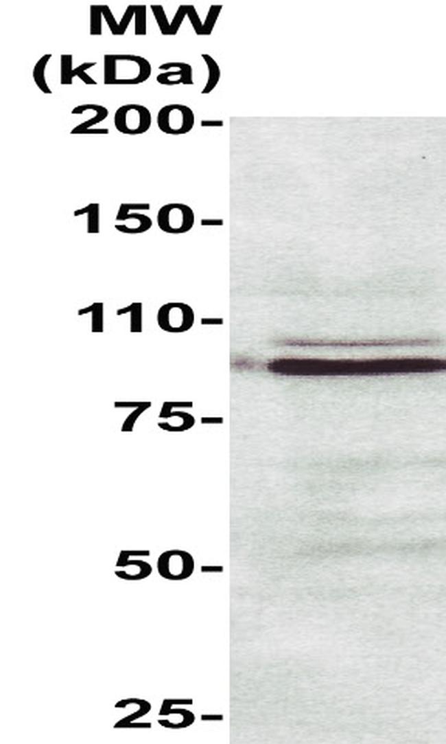 Heat Shock Factor 2 Antibody in Western Blot (WB)