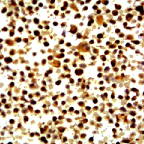 I-Kappa-B Kinase b (IKKb) Antibody in Immunocytochemistry (ICC/IF)