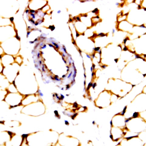 JNK Activating kinase (JKK1) Antibody in Immunohistochemistry (Paraffin) (IHC (P))