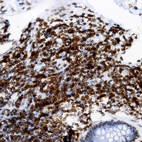 MHC I (HLA-A,B,C) Antibody in Immunohistochemistry (Paraffin) (IHC (P))