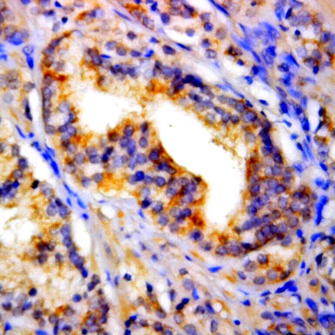 p73 Antibody in Immunohistochemistry (Paraffin) (IHC (P))