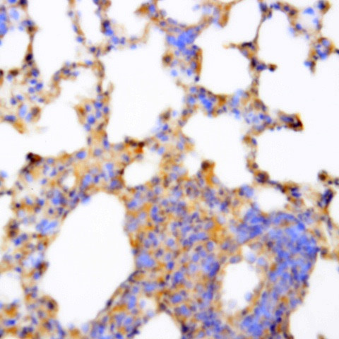 PLC gamma 1 Antibody in Immunohistochemistry (Paraffin) (IHC (P))