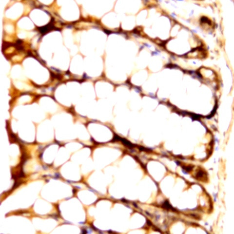 Raf-1 Antibody in Immunohistochemistry (Paraffin) (IHC (P))