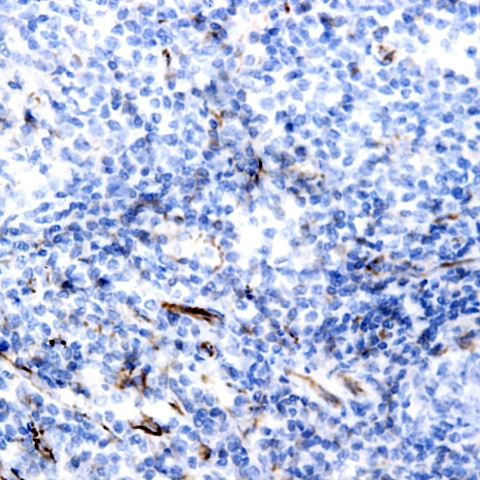 IL-4 Antibody in Immunohistochemistry (Paraffin) (IHC (P))