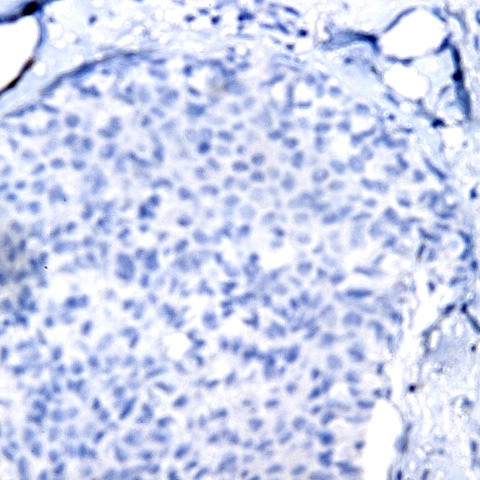 IL-6 Antibody in Immunohistochemistry (Paraffin) (IHC (P))