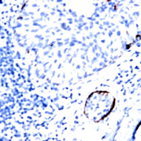IL-10 Antibody in Immunohistochemistry (Paraffin) (IHC (P))
