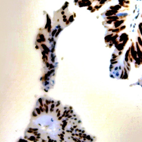 Phospho-Estrogen Receptor (ER) (Ser167) Antibody in Immunohistochemistry (Paraffin) (IHC (P))