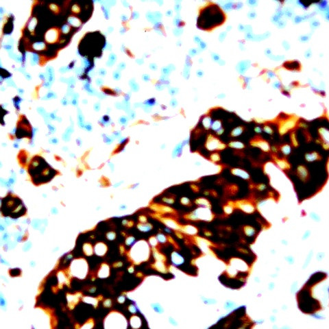 Phospho-IRS-1 (Ser312) Antibody in Immunohistochemistry (Paraffin) (IHC (P))