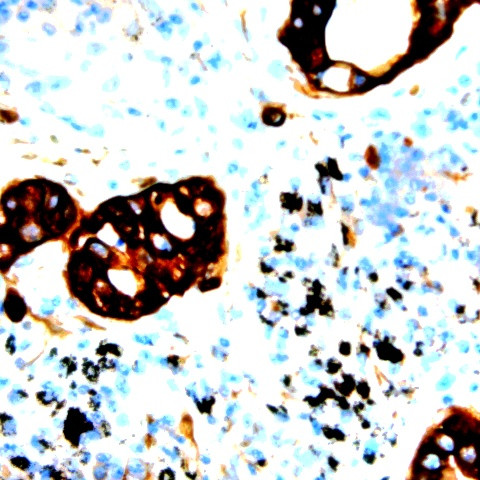 Phospho-IRS-2 (Ser731) Antibody in Immunohistochemistry (Paraffin) (IHC (P))