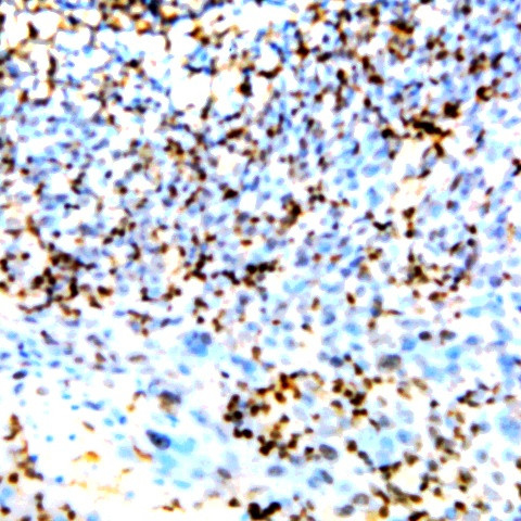 PKC Antibody in Immunohistochemistry (Paraffin) (IHC (P))
