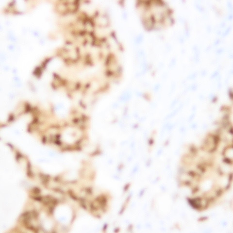 STAT1 Antibody in Immunohistochemistry (Paraffin) (IHC (P))