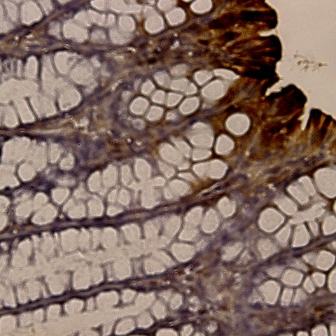 BAFF/BLys/Thank/Tall-1 Antibody in Immunohistochemistry (Paraffin) (IHC (P))