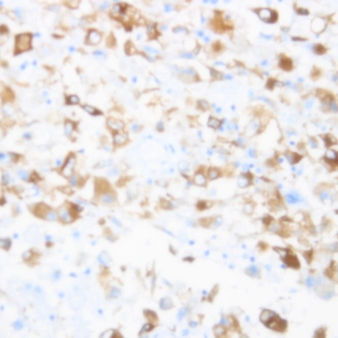 CCR5 Antibody in Immunohistochemistry (Paraffin) (IHC (P))