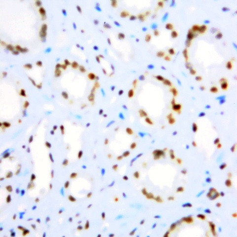 CIS-1 Antibody in Immunohistochemistry (Paraffin) (IHC (P))
