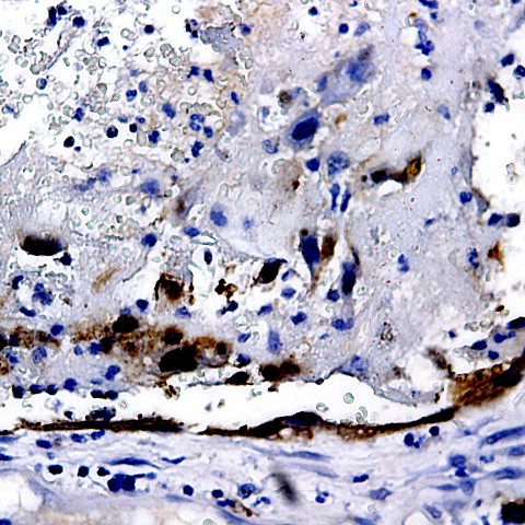IRAK-2 Antibody in Immunohistochemistry (Paraffin) (IHC (P))