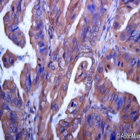 IRAK-M Antibody in Immunohistochemistry (Paraffin) (IHC (P))