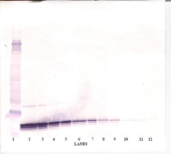 TECK Antibody in Western Blot (WB)