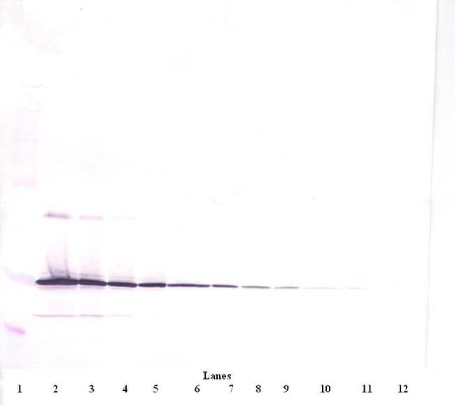 IL-11 Antibody in Western Blot (WB)