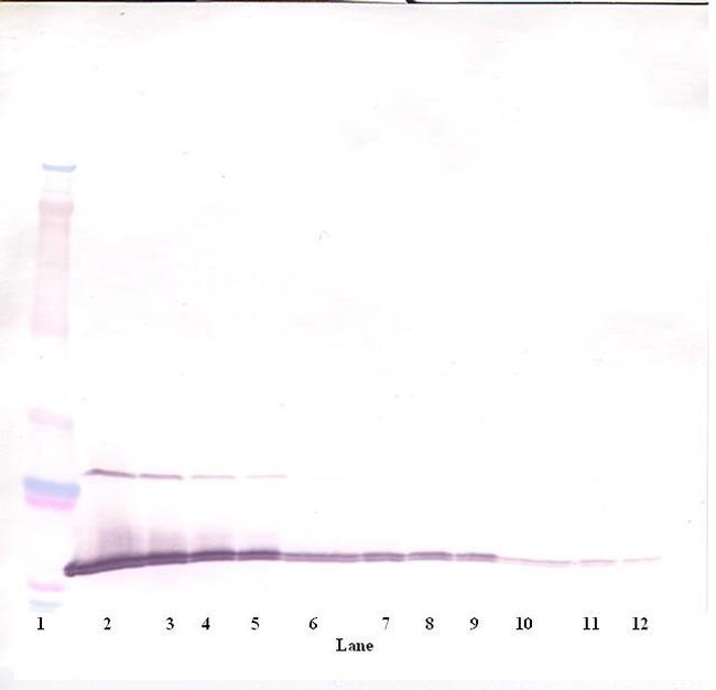 MIA Antibody in Western Blot (WB)
