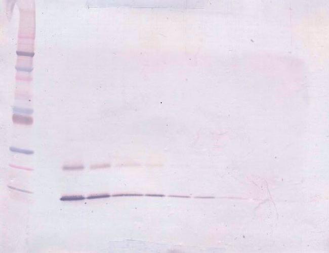 PTHLH Antibody in Western Blot (WB)