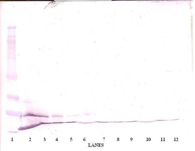 MCP-3 Antibody in Western Blot (WB)