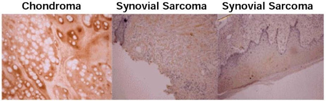 Osteocalcin Antibody in Immunohistochemistry (Paraffin) (IHC (P))