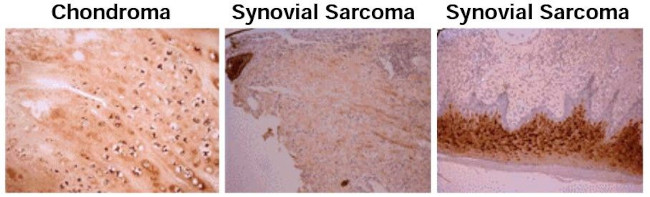 Osteocalcin Antibody in Immunohistochemistry (Paraffin) (IHC (P))