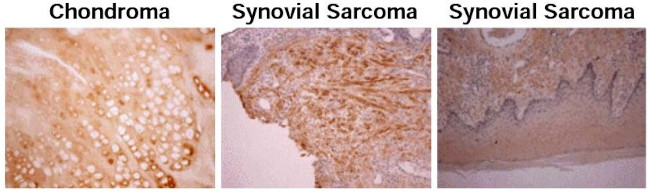 Osteocalcin Antibody in Immunohistochemistry (Paraffin) (IHC (P))