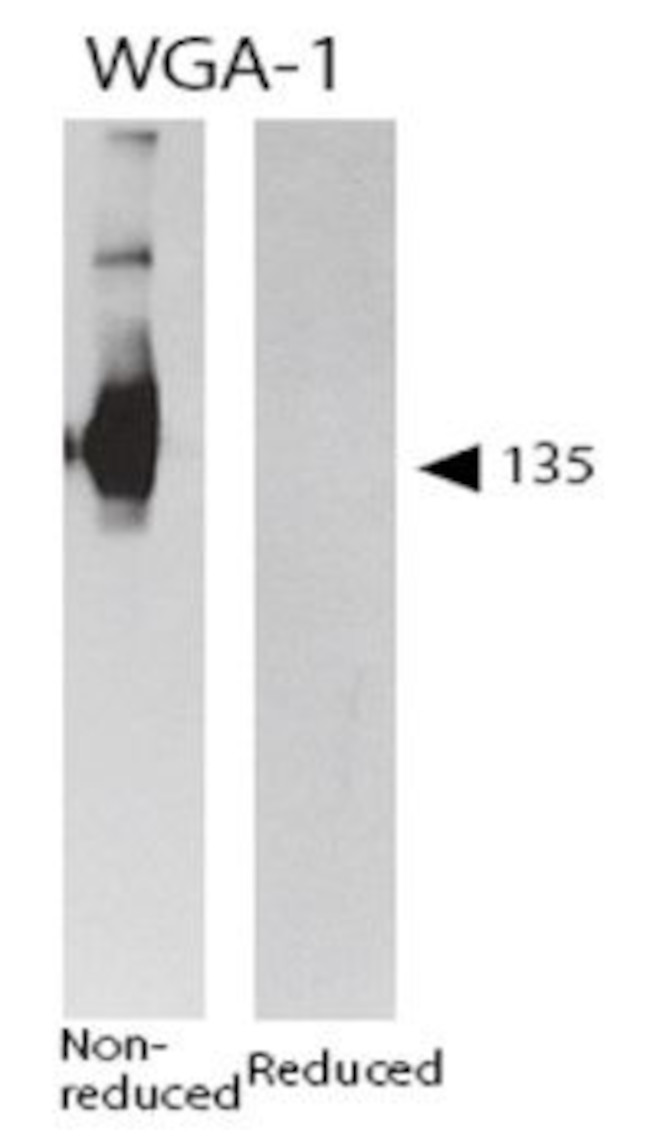 Platelet GMP-140 (P-selectin/CD62) Antibody in Immunohistochemistry (Frozen) (IHC (F))