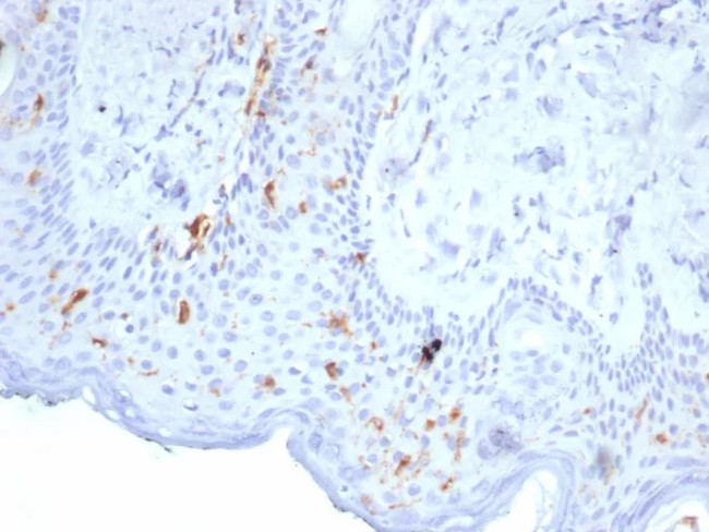 Langerin/CD207 (Marker of Langerhans Cells) Antibody in Immunohistochemistry (Paraffin) (IHC (P))
